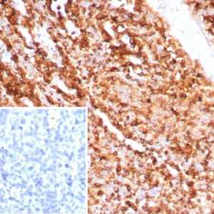 Formalin-fixed, paraffin-embedded human tonsil stained with CD74 Mouse Monoclonal Antibody (CLIP/7945) at 2ug/ml. Inset: PBS instead of primary antibody; secondary only negative control.
