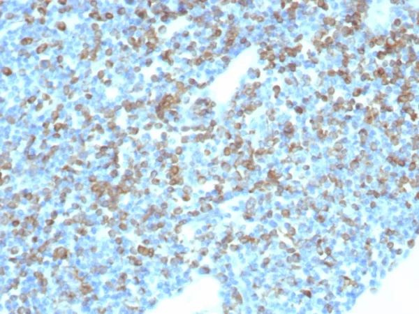 CD74 (B-Cell Marker) (Transcription Regulator) Antibody