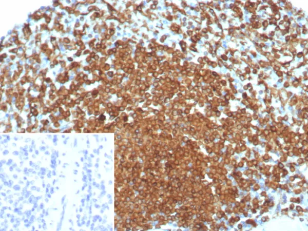 Formalin-fixed, paraffin-embedded human spleen stained with CD74 Recombinant Mouse Monoclonal Antibody (rCLIP/8679). Inset: PBS instead of primary antibody; secondary only negative control.