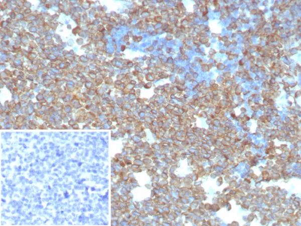 Recombinant CD74 (B-Cell Marker) (Transcription Regulator) Antibody