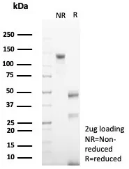 SDS-PAGE Analysis of Purified CD79a Recombinant Mouse Monoclonal Antibody (rIGA/6986). Confirmation of Purity and Integrity of Antibody.