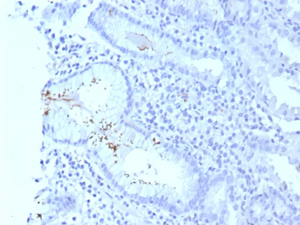 Formalin-fixed, paraffin-embedded human H. pylori-infected stomach stained with H. pylori Recombinant Rabbit Monoclonal Antibody (HPYL/8575R). HIER: Tris/EDTA, pH9.0, 45min. 2°C: HRP-polymer, 30min. DAB, 5min.