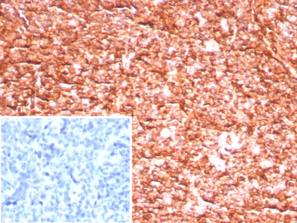 Formalin-fixed, paraffin-embedded human tonsil stained with HLA 1 ABC Recombinant Rabbit Monoclonal Antibody (MHC-I/8147R). Inset: PBS instead of primary antibody; secondary only negative control.