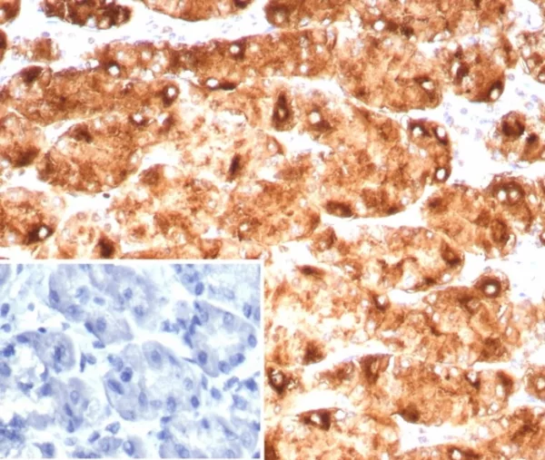 Recombinant Lewis Y (Tumor Marker) Antibody