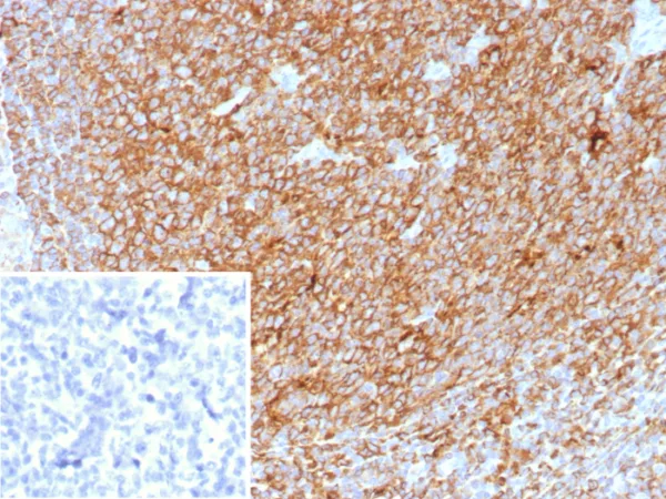 Formalin-fixed, paraffin-embedded human tonsil stained with HLA-Pan Rabbit Recombinant Monoclonal Antibody (HLA-Pan/8622R). Inset: PBS instead of primary antibody; secondary only negative control.