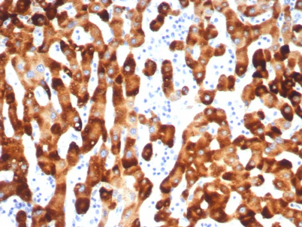 Recombinant HBsAg (Hepatitis B surface Ag a determinant) Antibody - Image 2