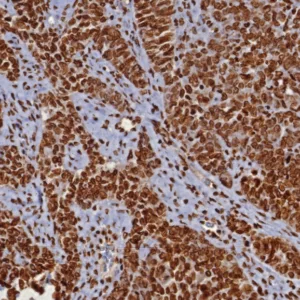 dsDNA Antibody in Immunohistochemistry (IHC (P))