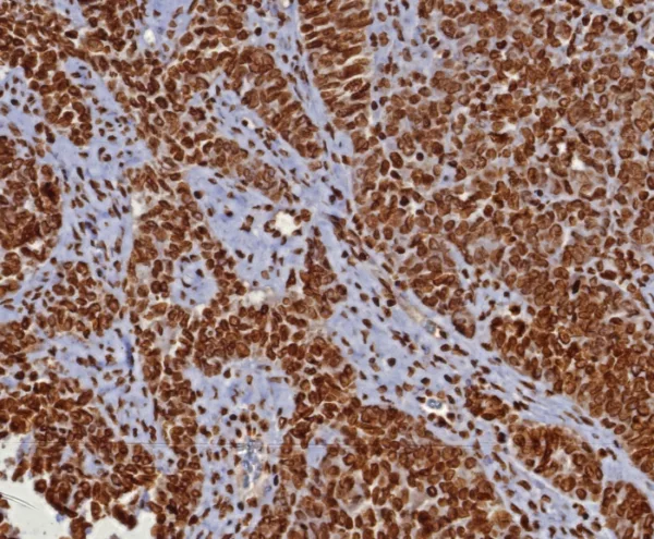 dsDNA Antibody in Immunohistochemistry (IHC (P))