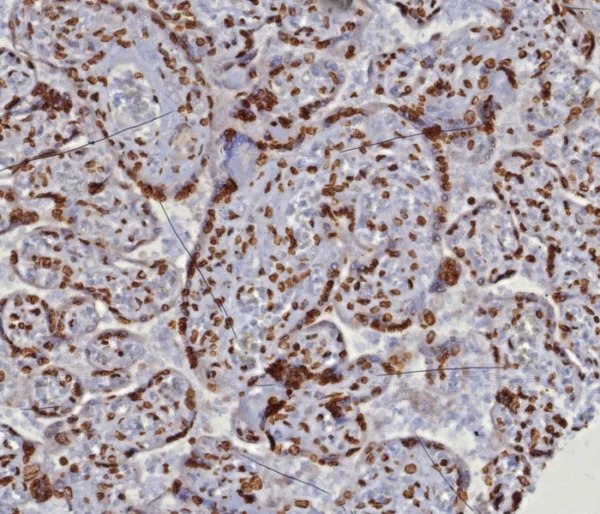 dsDNA Antibody in Immunohistochemistry (IHC (P))