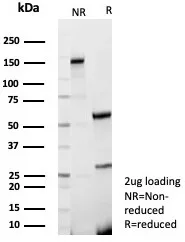 SDS-PAGE Analysis of Purified HuNu Recombinant Rabbit Monoclonal Antibody (235-1R). Confirmation of Purity and Integrity of Antibody.