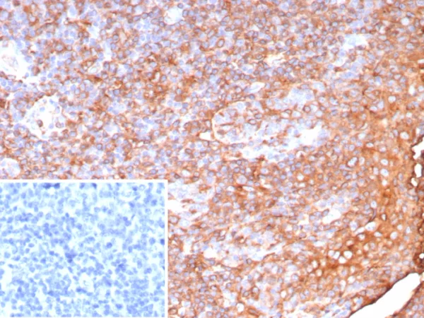 Formalin-fixed, paraffin-embedded human tonsil stained with HLA-Pan Rabbit Recombinant Monoclonal Antibody (HLA-Pan/9268R). Inset: PBS instead of primary antibody; secondary only negative control.