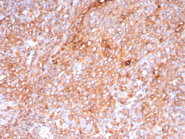 Formalin-fixed, paraffin-embedded human tonsil stained with HLA-Pan Rabbit Recombinant Monoclonal Antibody (HLA-Pan/9268R). HIER: Tris/EDTA, pH9.0, 45min. 2°C: HRP-polymer, 30min. DAB, 5min.