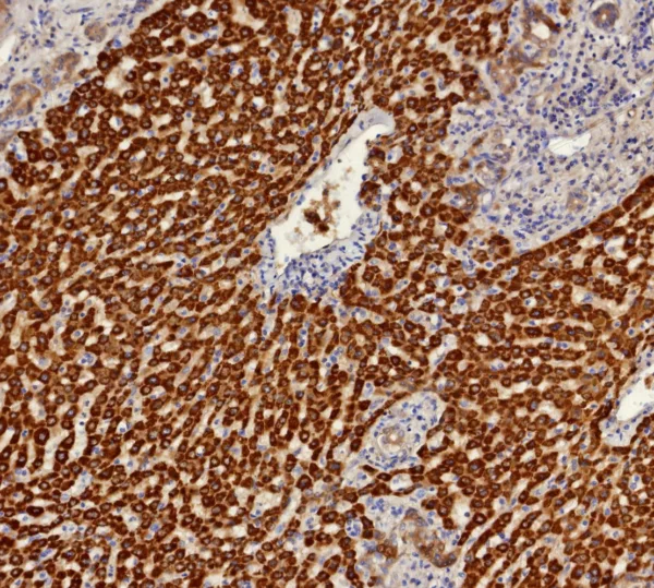 AKR1C1 Antibody in Immunohistochemistry (Paraffin) (IHC (P))