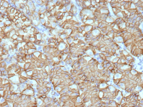 CA9 Antibody in Immunohistochemistry (IHC (P))