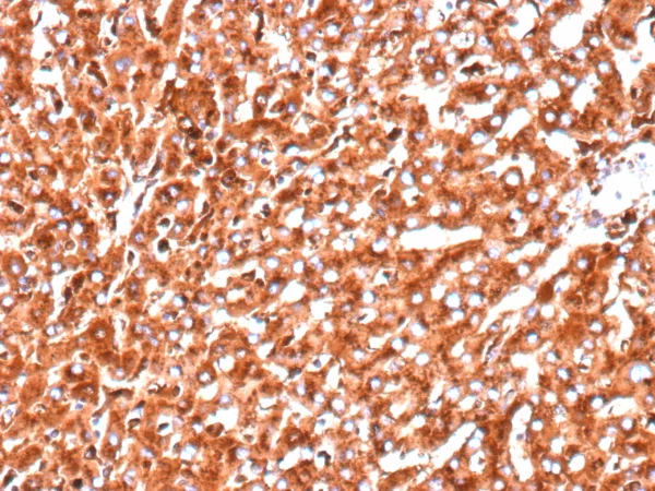 Cathepsin D Antibody in Immunohistochemistry (IHC (P))