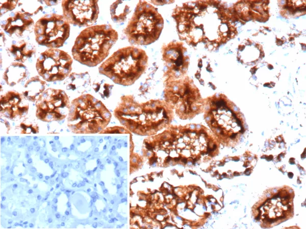 CD10 Antibody in Immunohistochemistry (IHC (P))