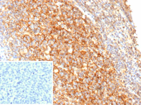 CD21 Antibody in Immunohistochemistry (IHC (P)).