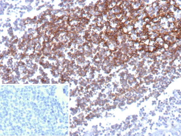 CD35 Antibody in Immunohistochemistry (IHC (P)).