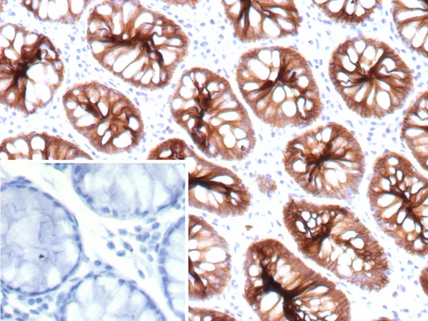 CDH17 Antibody in Immunohistochemistry (IHC (P))