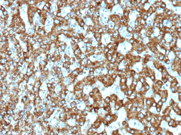 EPHB4 Antibody in Immunohistochemistry (IHC (P))