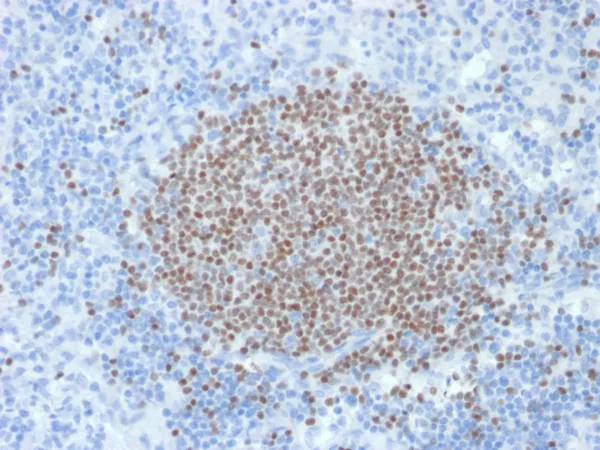 PAX5 Antibody in Immunohistochemistry (IHC (P))