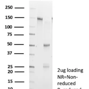 Creatine Kinase MM Antibody in SDS-PAGE