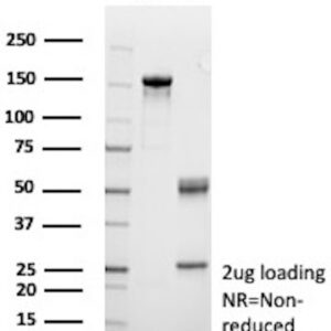 Clusterin / Apo-J / APOJ Antibody in SDS-PAGE