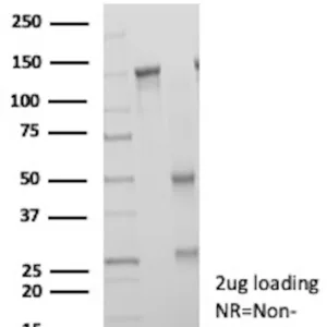 TIGIT Antibody in SDS-PAGE