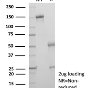 TIGIT Antibody in SDS-PAGE