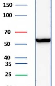 Estrogen Receptor Beta 2 Antibody in Western Blot (WB)