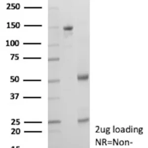 IgG1 Immunoglobulin Antibody in SDS-PAGE