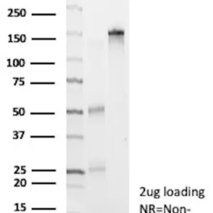 CD7 Antibody in SDS-PAGE