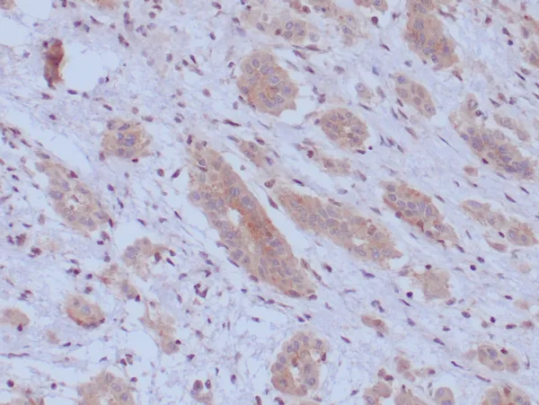 BAP1 Antibody in Immunohistochemistry (IHC (P))