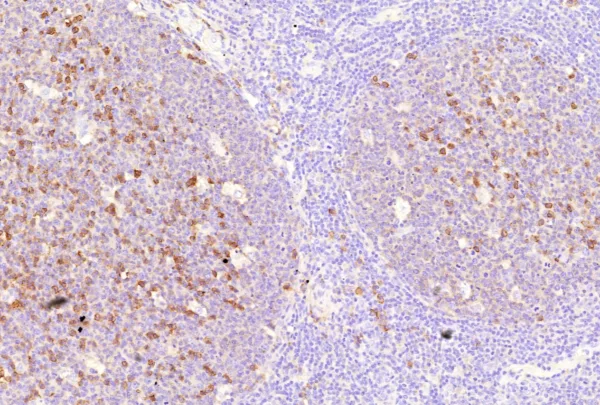 CD38 Antibody in Immunohistochemistry (IHC (P))