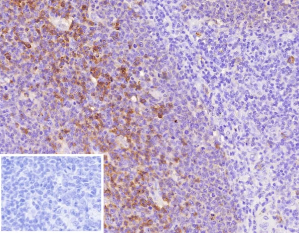 CD38 Antibody in Immunohistochemistry (IHC (P))