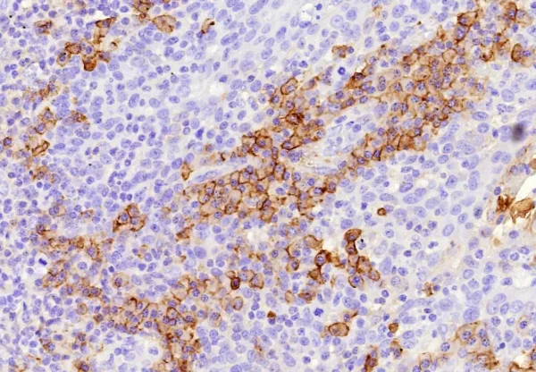 CD38 Antibody in Immunohistochemistry (IHC (P))