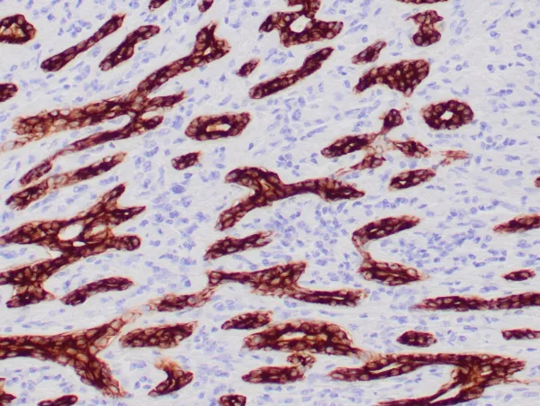 Cytokeratin Antibody in Immunohistochemistry (IHC (P))