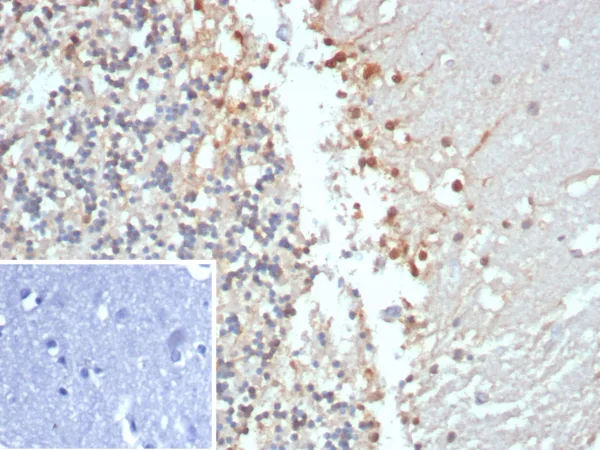 Creatine Phosphokinase-BB Antibody in Immunohistochemistry (IHC (P))