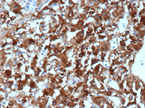 Clusterin Antibody in Immunohistochemistry (IHC (P))