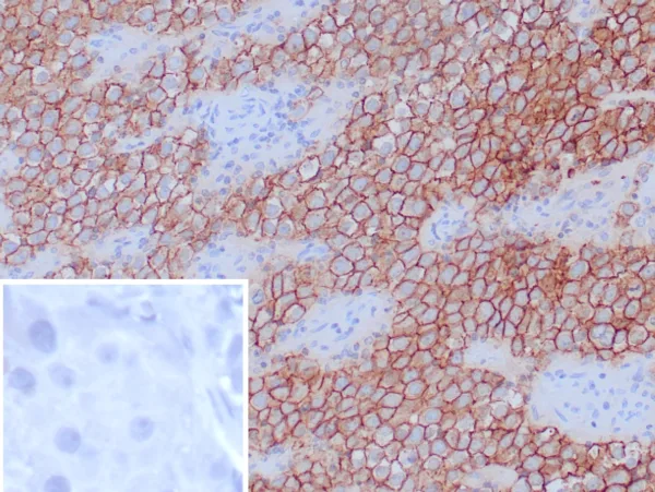 Podoplanin Antibody in Immunohistochemistry (IHC (P))