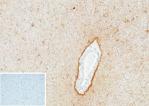 GFAP Antibody in Immunohistochemistry (IHC (P))