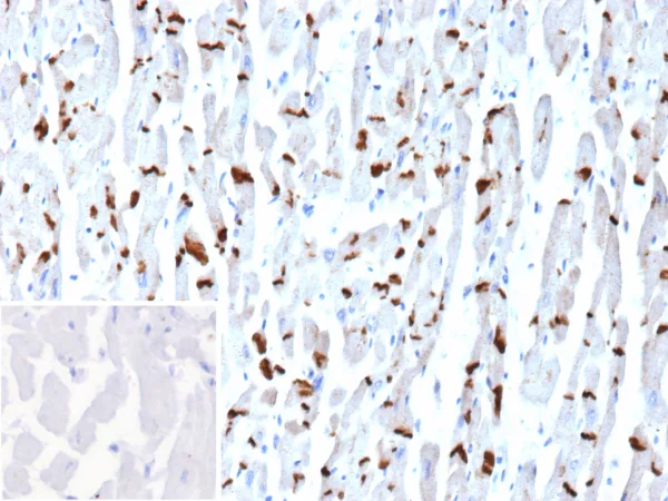 N-Cadherin Antibody in Immunohistochemistry (IHC (P))