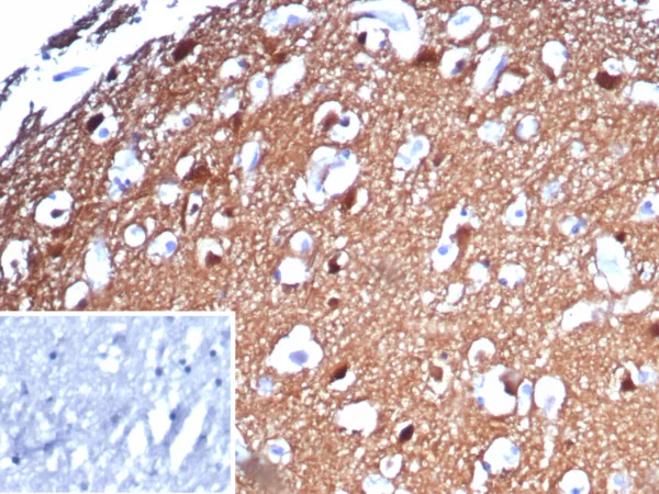 PGP9.5 Antibody in Immunohistochemistry (IHC (P))