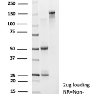 D-Dimer Antibody in SDS-PAGE