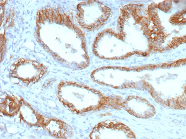 ABCC4 Antibody in Immunohistochemistry (IHC (P))