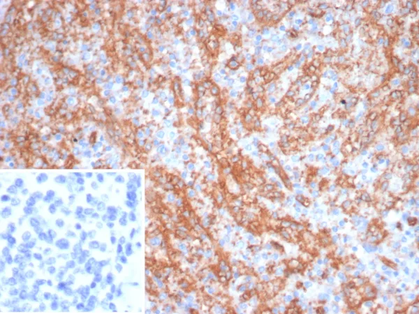 CD36 Antibody in Immunohistochemistry (IHC (P))