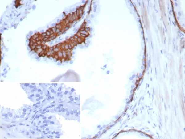 Cytokeratin 13 Antibody in Immunohistochemistry (IHC (P))