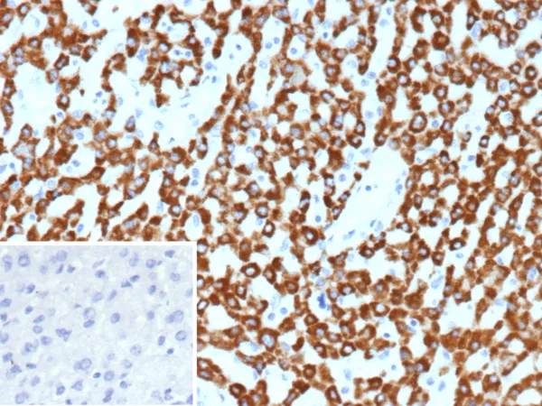 CPS1 Antibody in Immunohistochemistry (IHC (P))