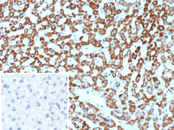 CPS1 Antibody in Immunohistochemistry (IHC (P))