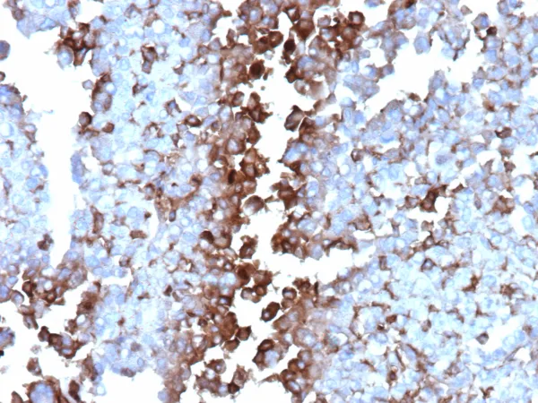Clusterin Antibody in Immunohistochemistry (IHC (P))
